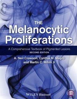 Bertrand.pt - Melanocytic Proliferations