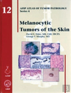 Bertrand.pt - Melanocytic Tumors Of The Skin