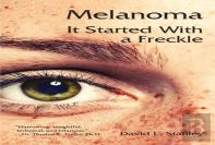Melanoma