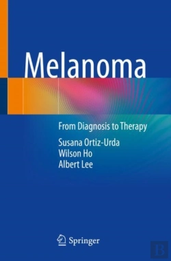 Bertrand.pt - Melanoma