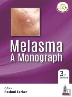Bertrand.pt - Melasma: A Monograph