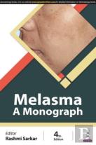 Melasma