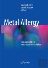 Metal Allergy