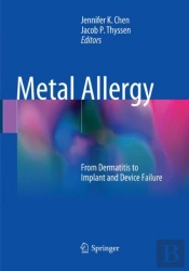 Metal Allergy