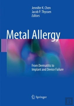 Bertrand.pt - Metal Allergy