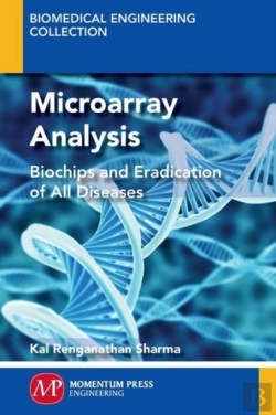 Bertrand.pt - Microarray Analysis