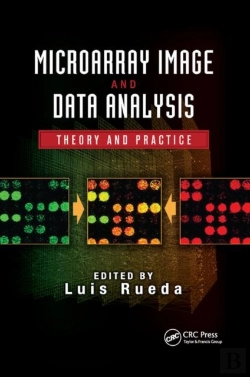 Bertrand.pt - Microarray Image And Data Analysis