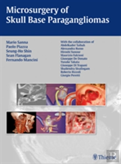 Bertrand.pt - Microsurgery Of Skull Base Paragangliomas