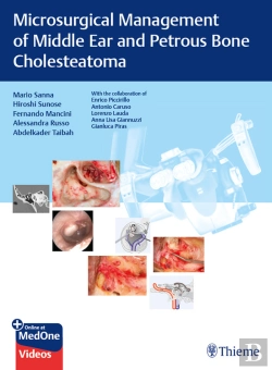 Bertrand.pt - Microsurgical Management Of Middle Ear And Petrous Bone Cholesteatoma