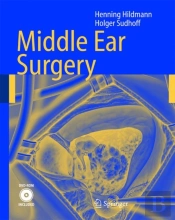 Middle Ear Surgery