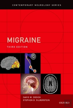 Bertrand.pt - Migraine