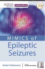Mimics Of Epileptic Seizures
