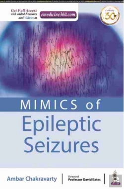 Bertrand.pt - Mimics Of Epileptic Seizures