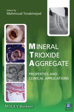 Bertrand.pt - Mineral Trioxide Aggregate