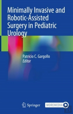 Bertrand.pt - Minimally Invasive And Robotic-Assisted Surgery In Pediatric Urology