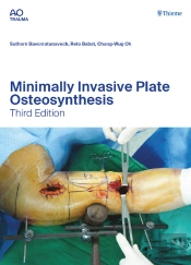 Minimally Invasive Plate Osteosynthesis