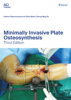 Bertrand.pt - Minimally Invasive Plate Osteosynthesis