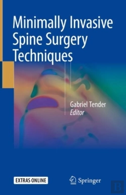 Bertrand.pt - Minimally Invasive Spine Surgery Techniques