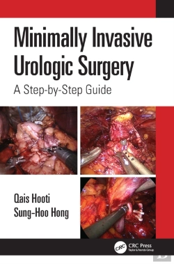 Bertrand.pt - Minimally Invasive Urologic Surgery