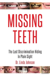Missing Teeth: The Last Discrimination H