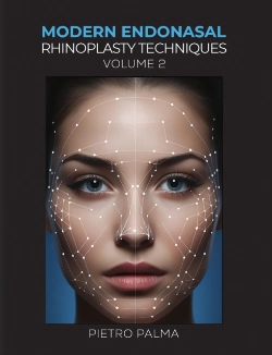 Bertrand.pt - Modern Endonasal Rhinoplasty Techniques Â€“ Volume 2