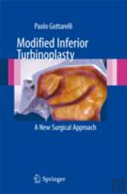 Bertrand.pt - Modified Inferior Turbinoplasty