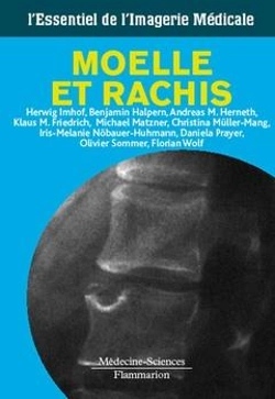 Bertrand.pt - Moëlle Et Rachis