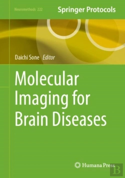 Bertrand.pt - Molecular Imaging For Brain Diseases
