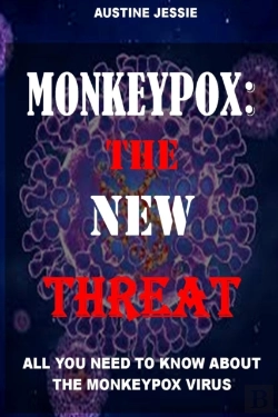 Bertrand.pt - Monkeypox