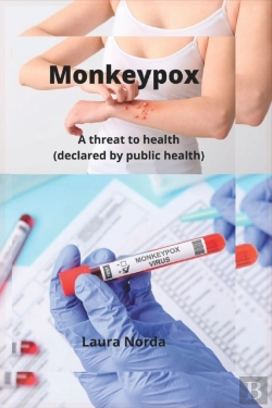 Bertrand.pt - Monkeypox