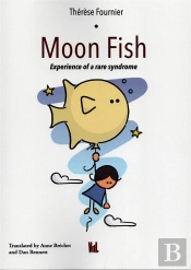 Moon Fish - Experience Of A Rare Syndrome