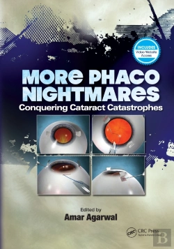 Bertrand.pt - More Phaco Nightmares