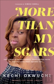 More Than My Scars Â€“ The Power Of Perseverance, Unrelenting Faith, And Deciding What Defines You