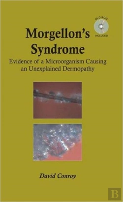 Bertrand.pt - Morgellon'S Syndrome