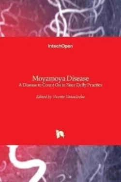Bertrand.pt - Moyamoya Disease