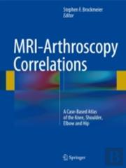 Mri-Arthroscopy Correlations