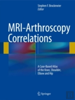 Bertrand.pt - Mri-Arthroscopy Correlations