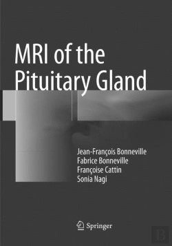 Bertrand.pt - Mri Of The Pituitary Gland