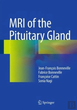 Bertrand.pt - Mri Of The Pituitary Gland