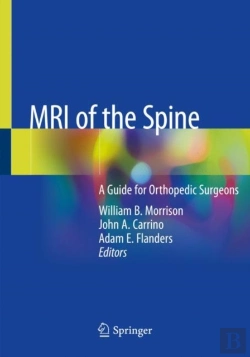 Bertrand.pt - Mri Of The Spine