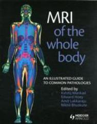 Mri Of The Whole Body