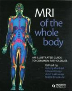 Bertrand.pt - Mri Of The Whole Body