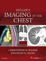 Muller'S Imaging Of The Chest E-Book