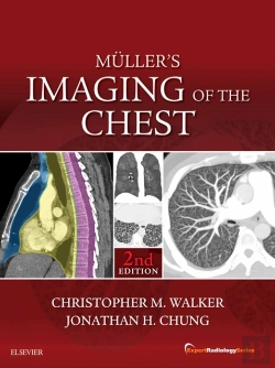 Bertrand.pt - Muller'S Imaging Of The Chest E-Book
