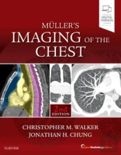 Muller'S Imaging Of The Chest