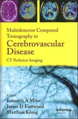 Bertrand.pt - Multidetector Computed Tomography In Cerebrovascular Disease