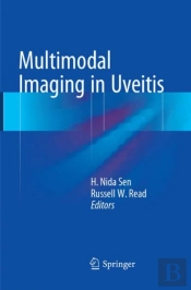 Multimodal Imaging In Uveitis