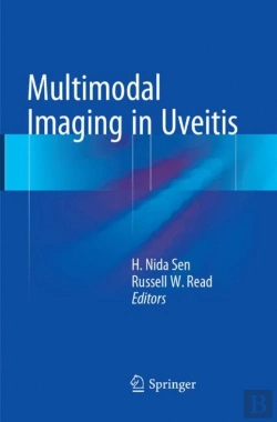 Bertrand.pt - Multimodal Imaging In Uveitis