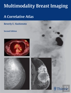 Bertrand.pt - Multimodality Breast Imaging