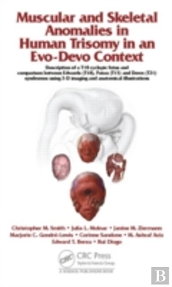 Bertrand.pt - Muscular And Skeletal Anomalies In Human Trisomy In An Evo-Devo Context